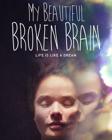 Khối óc xinh đẹp tội nghiệp của tôi - My Beautiful Broken Brain (2016)